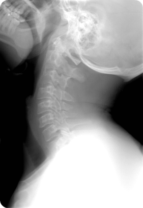 spinal realignment, chronic pain relief, sports injury treatment at Greenfield chiropractor
